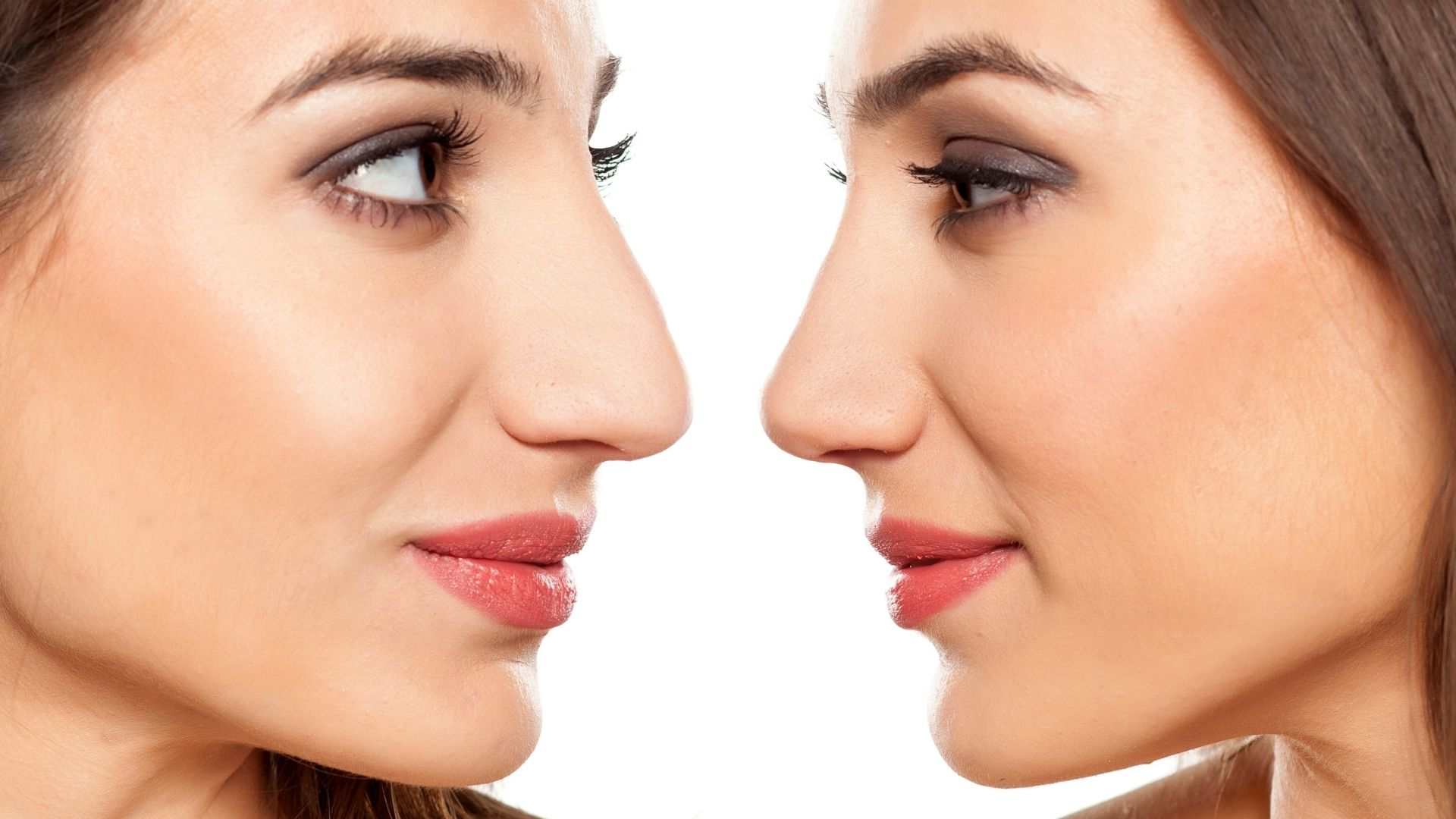 Male Rhinoplasty: A Procedure Designed for Masculine Facial Features